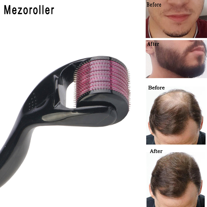 Mezoroller Beard Derma Roller – DRS 540 Needles for Hair Growth &amp; Skin Care