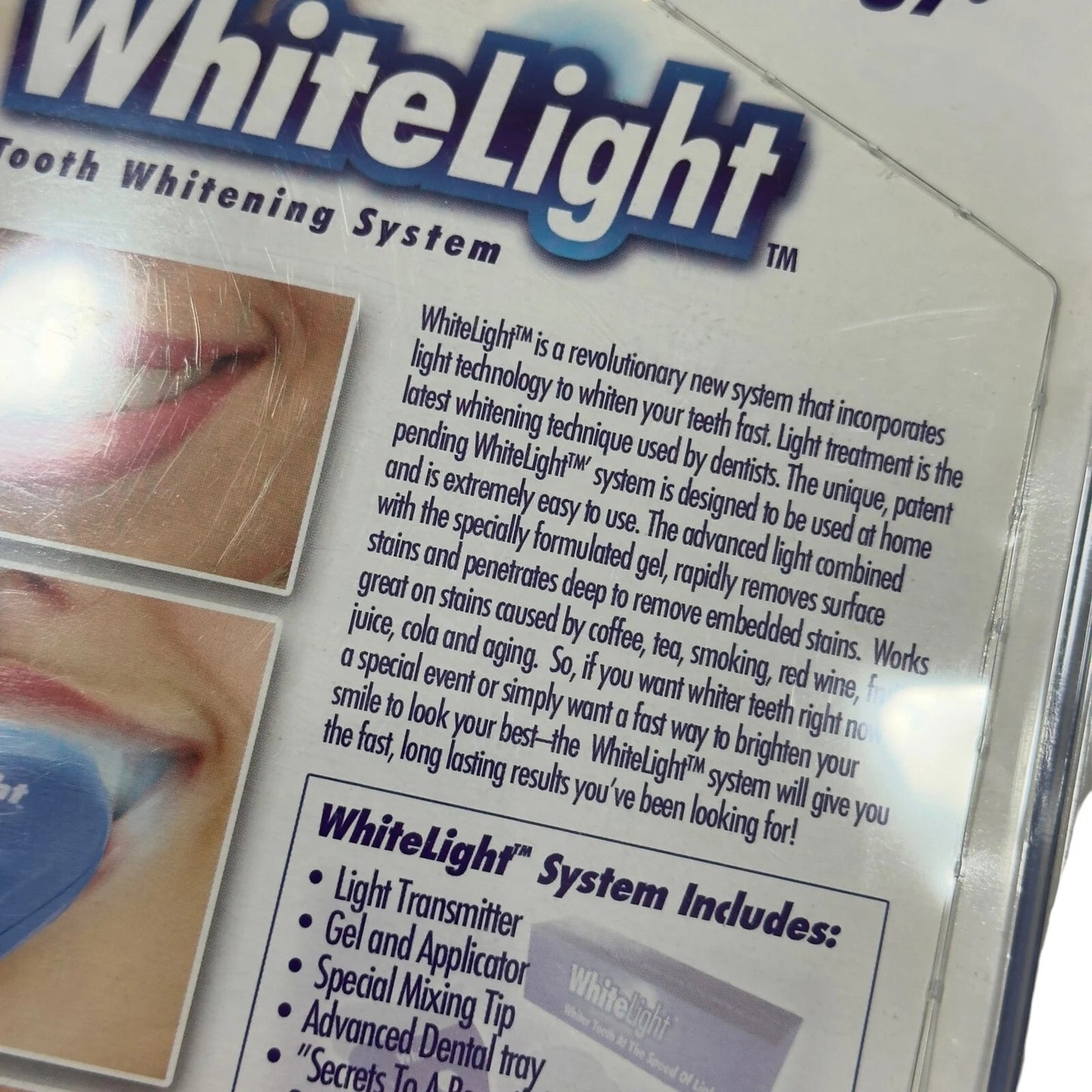 WhiteLight Dental Teeth Whitening Light Kit – Fast & Easy Tooth Whitening System