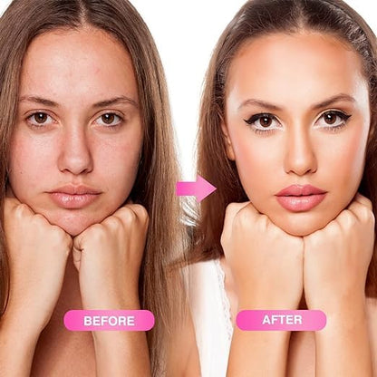 Derma Roller 0.5mm – 540 Titanium Needles for Skin & Hair – Men & Women – Bahrain