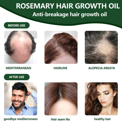Rosemary Hair Growth Oil – Anti Hair Loss & Scalp Nourishing Solution