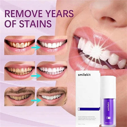 Hismile V34 Colour Corrector – Purple Teeth Whitening Tooth Stain Remover