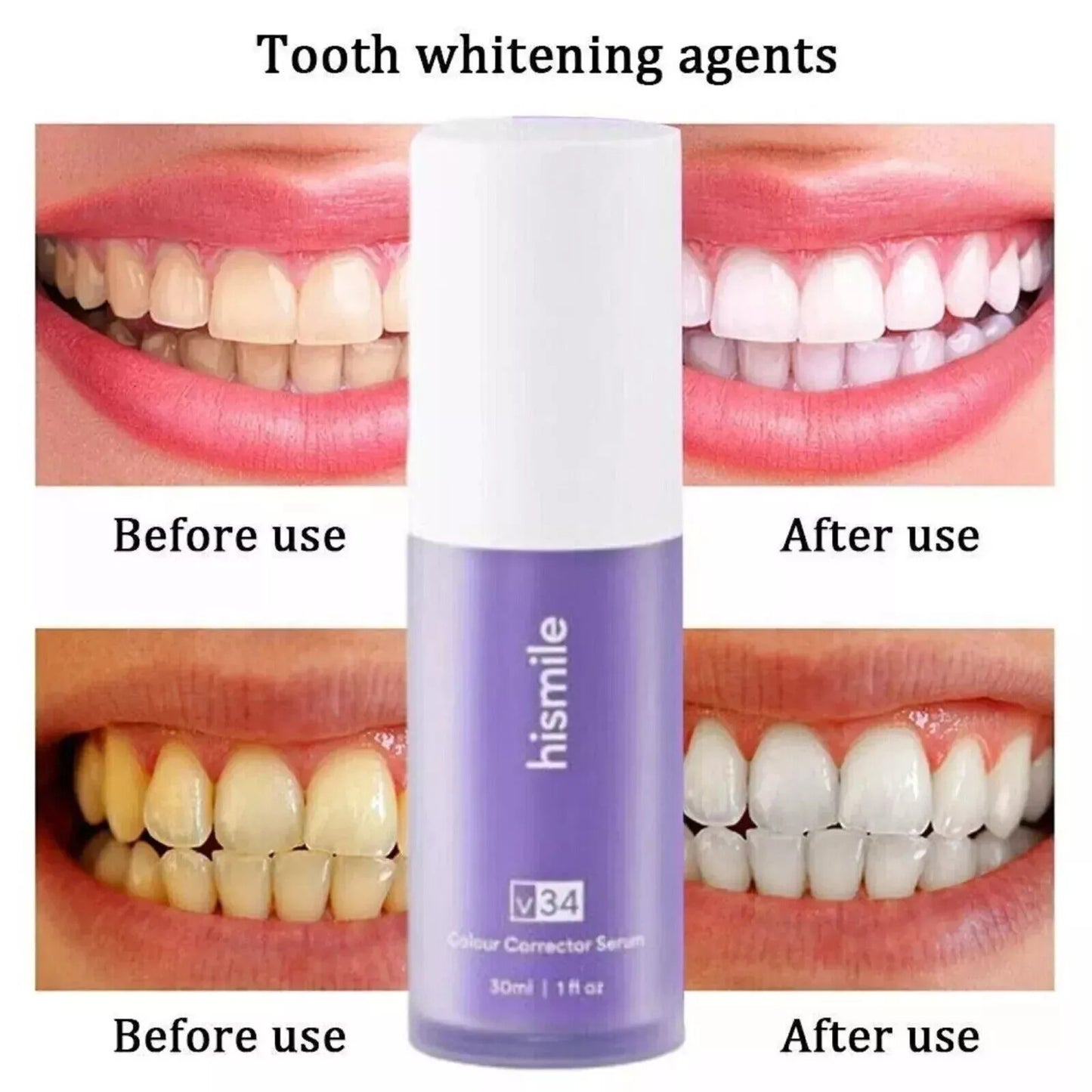 Hismile V34 Colour Corrector – Purple Teeth Whitening Tooth Stain Remover