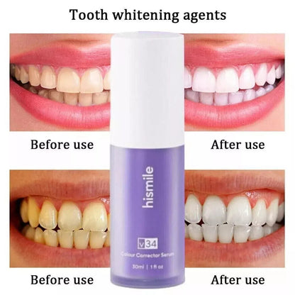 Hismile V34 Colour Corrector – Purple Teeth Whitening Tooth Stain Remover