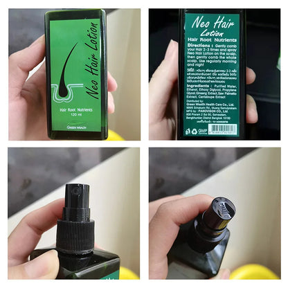 Neo Hair Growth Lotion – Original Thai Formula for Stronger, Thicker Hair