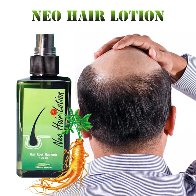 Neo Hair Growth Lotion – Original Thai Formula for Stronger, Thicker Hair
