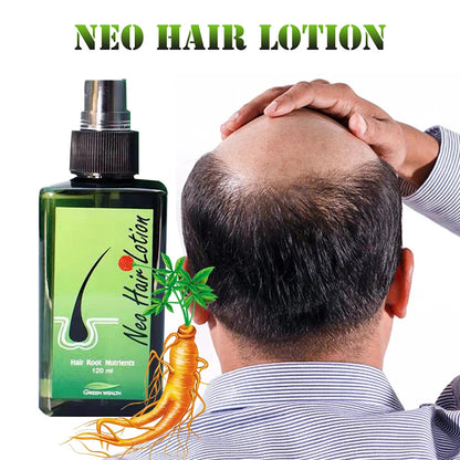 Neo Hair Growth Lotion – Original Thai Formula for Stronger, Thicker Hair